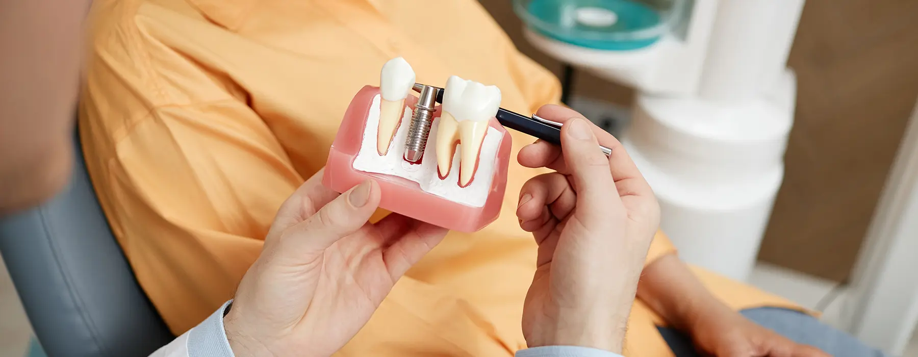 Dental Implant Procedure: A Step-by-Step Guide