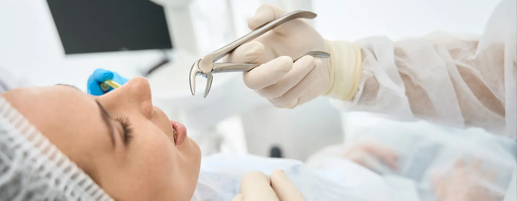 10 FAQs About Tooth Extractions