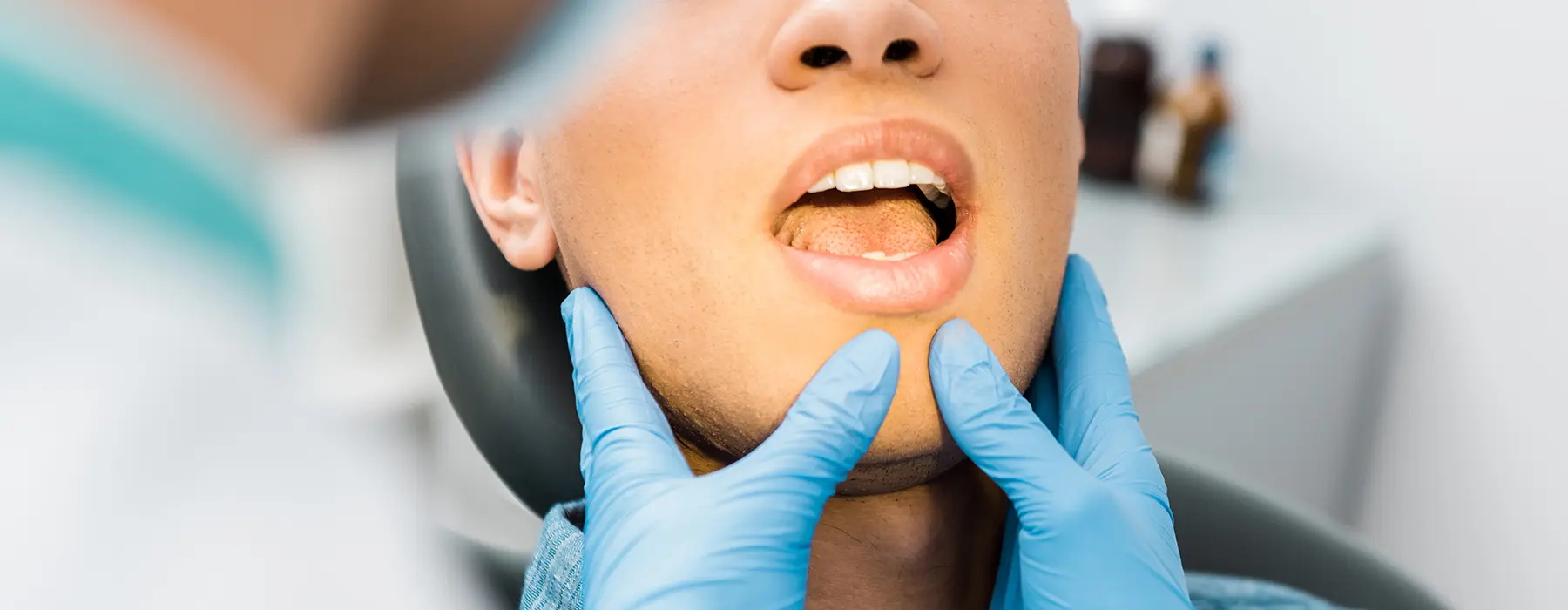 Is a Frenectomy Necessary for Adults?