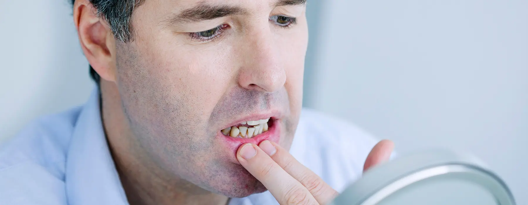 Linea Alba in the Mouth: Is It Normal or Cause for Concern?