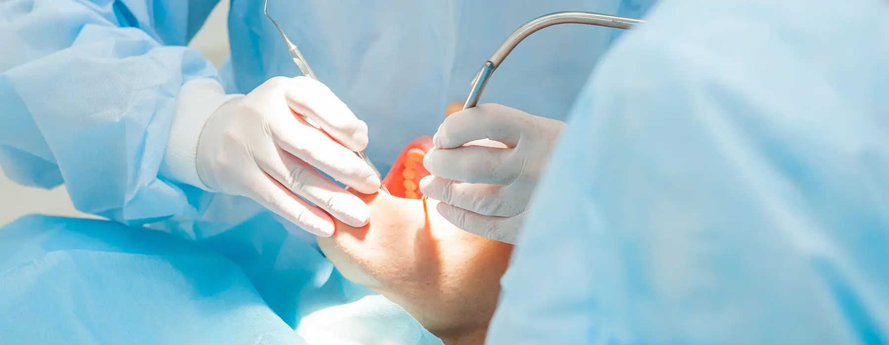 Alveoloplasty: The Key to Better Fitting Dentures