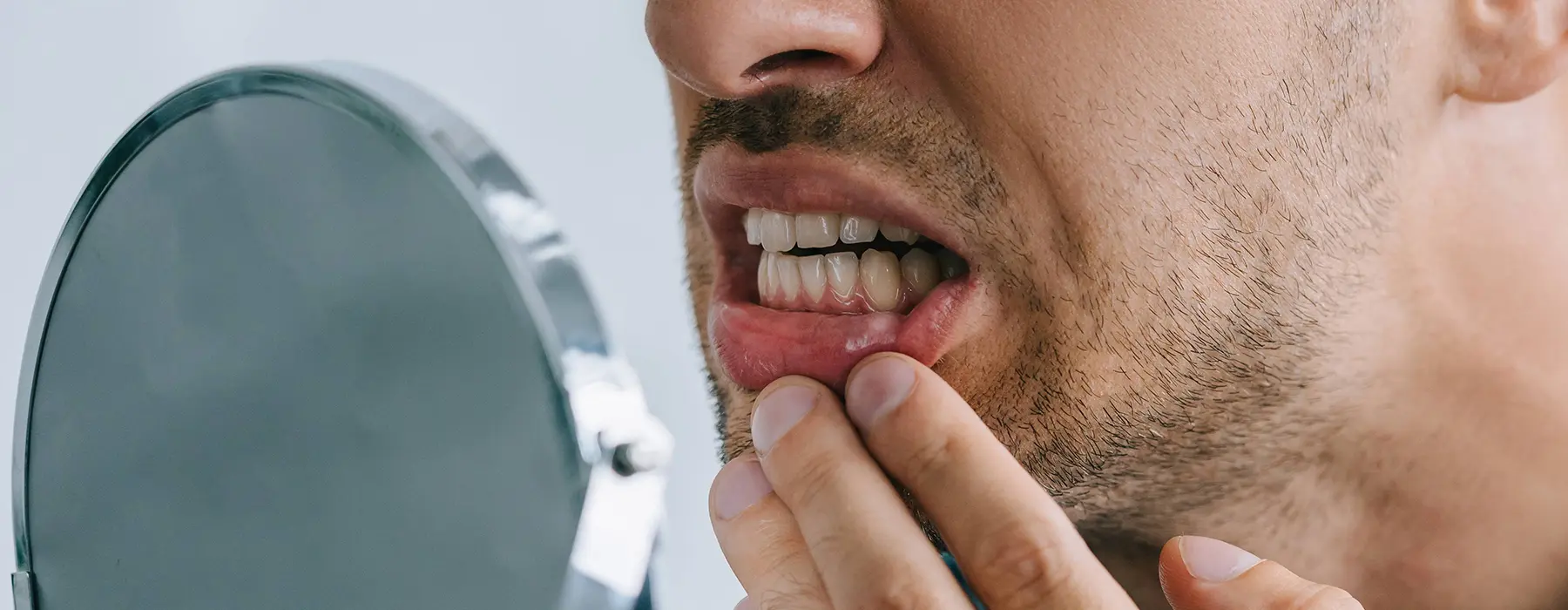 What to Know Before Getting Low-Cost Implants