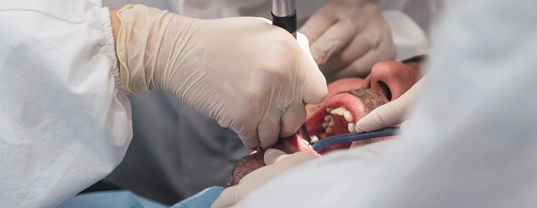 AZ Max: Oral Surgery Care for Arizona–New Mexico State Line Communities