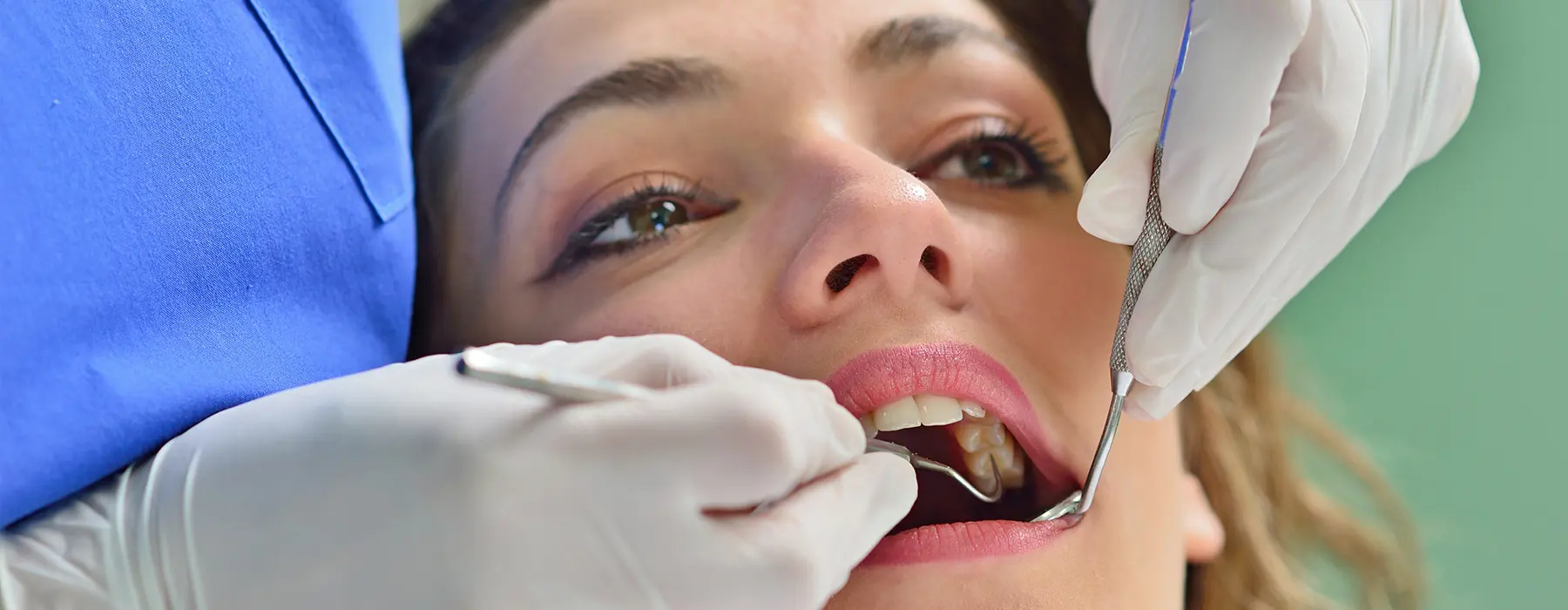 What Happens If You Don’t Replace a Missing Tooth?