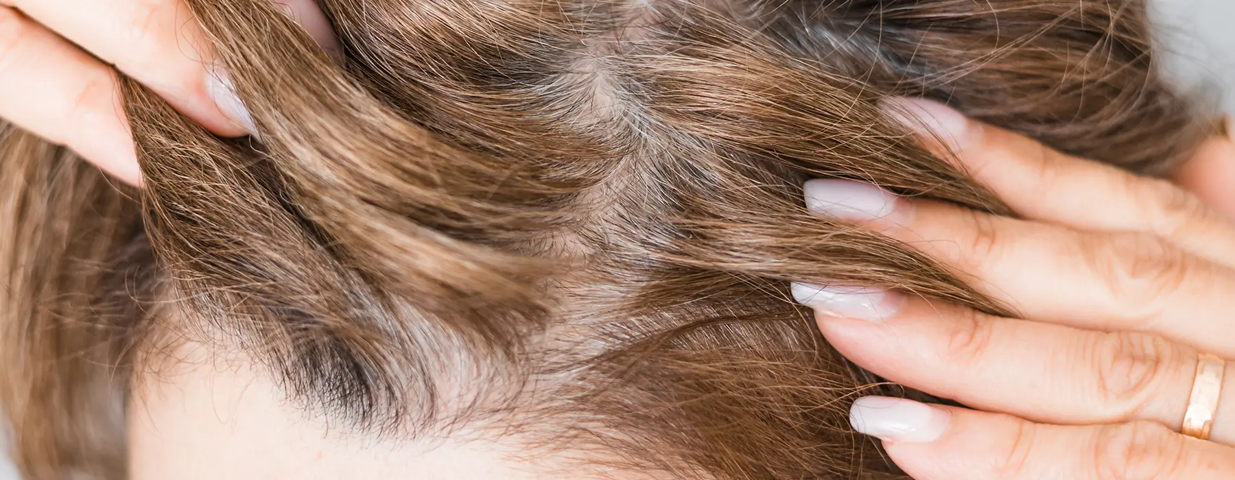 PRF Hair Restoration vs. Other Hair Loss Treatments