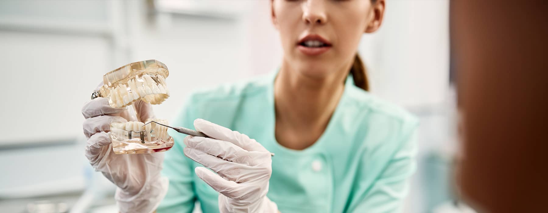 Traditional Implants vs. All-On-4® Dental Implants: What's The Difference?