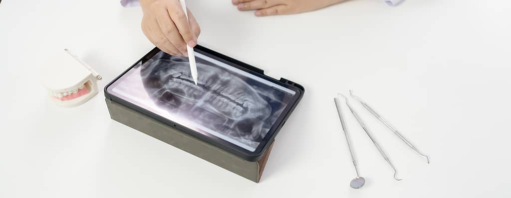 When to Consider Corrective Jaw Surgery - A Guide From the Experts at AZ Max Oral Surgery