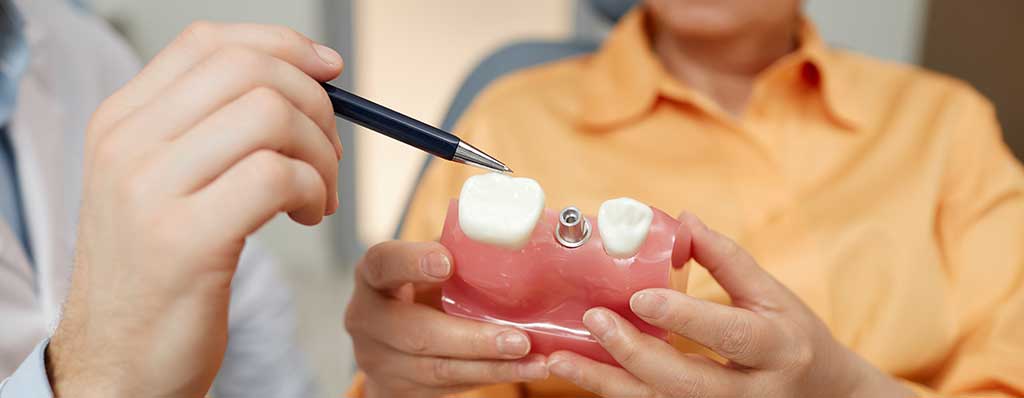 Everything You Need to Know About Hybrid Implants